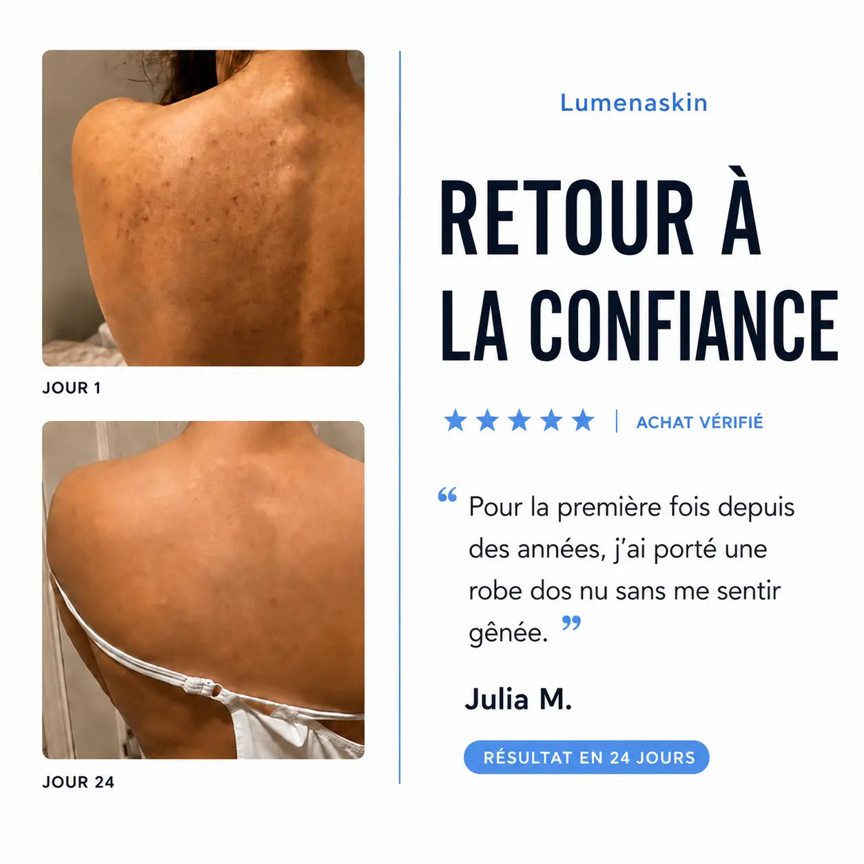 Barre anti-imperfections™
